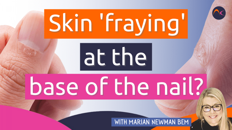 skin fraying nail