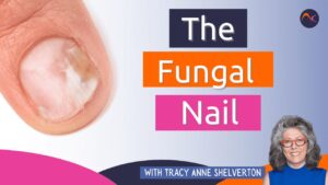 The fungal nail