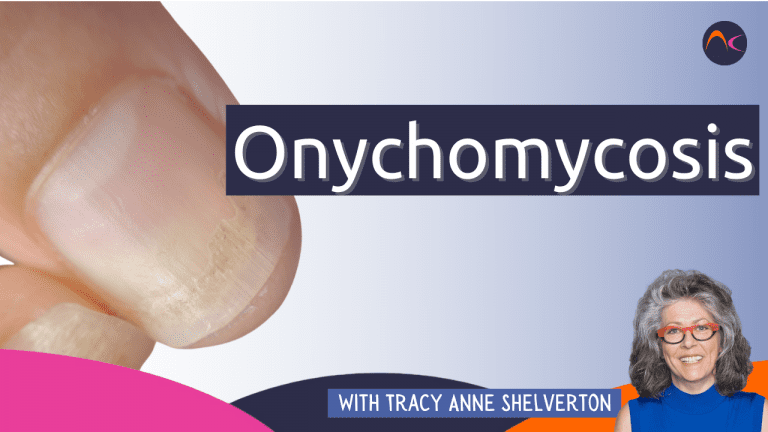 Onychomycosis