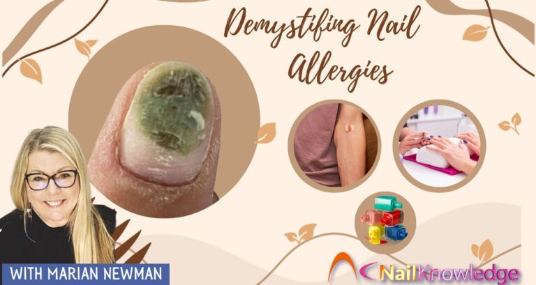 Demystifing Nail Allergies