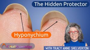The Hidden Protector: The Hyponychium