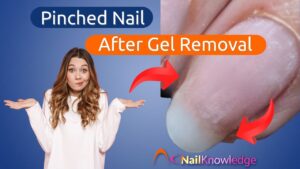 Pinched Nail After Gel Removal